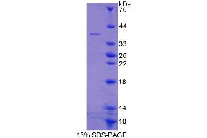SDS-PAGE analysis of Human GYPE Protein. (GYPE 蛋白)