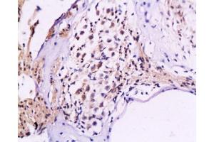 Formalin-fixed and paraffin embedded rat cochlea tissue labeled Anti-NF-M/Neurofilament M Polyclonal Antibody, Unconjugated  at 1:200, followed by conjugation to the secondary antibody and DAB staining (NEFM 抗体  (AA 101-200))