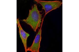Immunofluorescence (IF) image for anti-Von Hippel-Lindau Tumor Suppressor, E3 Ubiquitin Protein Ligase (VHL) (AA 43-71), (N-Term) antibody (ABIN390462)
