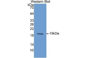 Western blot analysis of the recombinant protein. (LIFR 抗体  (AA 642-791))