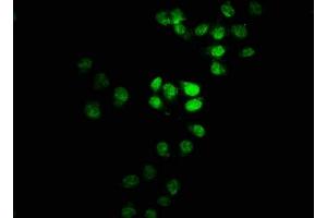 Immunofluorescence staining of Hela cells with ABIN7171492 at 1:100, counter-stained with DAPI. (TBKBP1 抗体  (AA 327-427))