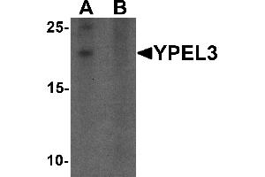 Western blot analysis of YPEL3 in A-20 cell lysate with YPEL3 antibody at 1 µg/mL in (A) the absence and (B) the presence of blocking peptide (YPEL3 抗体  (N-Term))