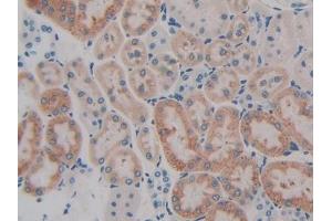 DAB staining on IHC-P; Samples: Rat Kidney Tissue (GIP 抗体  (AA 11-124))