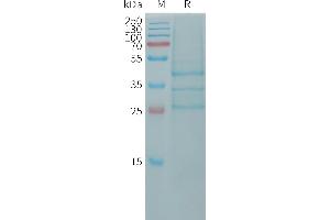 Bone Morphogenetic Protein 2 (BMP2) (AA 283-396) protein (Fc Tag)