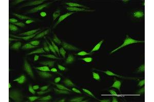 Immunofluorescence of purified MaxPab antibody to MAP3K7 on HeLa cell. (MAP3K7 抗体  (AA 1-579))