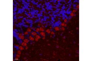 Immunofluorescence of paraffin embedded mouse cerebellum using ZNF295 (ABIN7076264) at dilution of 1: 650 (400x lens) (ZNF295 抗体)