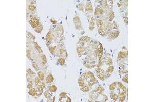 Immunohistochemistry of paraffin-embedded human stomach using HD antibody (ABIN6128012, ABIN6141669, ABIN6141672 and ABIN6213648) at dilution of 1:100 (40x lens). (HDAC4 抗体  (AA 451-650))