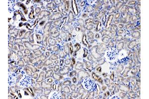 Immunohistochemistry (IHC) image for anti-serpin Peptidase Inhibitor, Clade A (Alpha-1 Antiproteinase, Antitrypsin), Member 5 (SERPINA5) (AA 86-406) antibody (ABIN5518789)