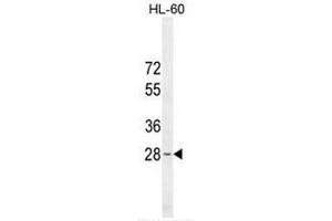 METTL10 Antibody (N-term) western blot analysis in HL-60 cell line lysates (35µg/lane). (METTL10 抗体  (N-Term))