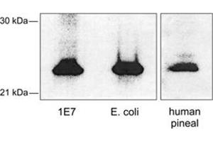Western blot analysis of AANAT using AANAT polyclonal antibody . (AANAT 抗体)