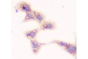 ICC testing of FFPE human A431 cells with SMN1/2 antibody. (SMN1 / SMN2 抗体)