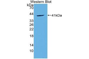 Western blot analysis of the recombinant protein. (CCL20 抗体  (AA 24-95))