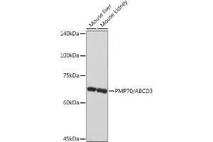 Western blot analysis of extracts of various cell lines, using PMP70/ Rabbit mAb (ABIN1683181, ABIN3018647, ABIN3018648 and ABIN7101638) at 1:1000 dilution. (CX3CL1 抗体)