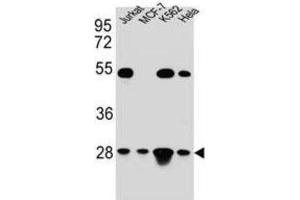 Western Blotting (WB) image for anti-Transcription Factor A, Mitochondrial (TFAM) antibody (ABIN5015230) (TFAM 抗体)