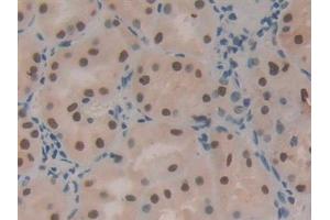 Detection of HDGF in Human Kidney Tissue using Polyclonal Antibody to Hepatoma Derived Growth Factor (HDGF) (HDGF 抗体  (AA 10-240))