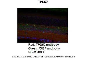 Application: ImmunofluorescenceSpecies+tissue/cell type: Mouse retina Primary Antibody dilution: 1:200Secondary Antibody: Goat anti-rabbit Alexafluor 568 Secondary Antibody Dilution: 1:000 (TPD52 抗体  (C-Term))