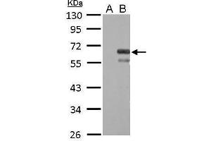 WB Image Factor X antibody detects F10 protein by Western blot analysis. (Coagulation Factor X 抗体)