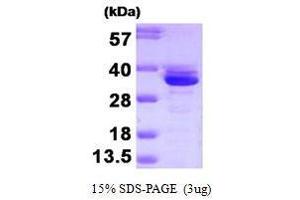 Figure annotation denotes ug of protein loaded and % gel used. (Annexin A3 Protein (ANXA3) (AA 1-323))