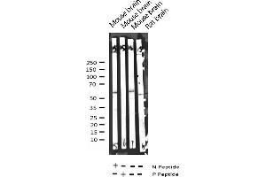 Western blot analysis of Phospho-Synaptotagmin (Thr202) expression in various lysates (Synaptotagmin 抗体  (pThr202))