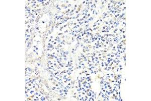 Immunohistochemistry (Paraffin-embedded Sections) (IHC (p)) image for anti-FK506 Binding Protein 5 (FKBP5) (AA 308-457) antibody (ABIN1679852)