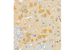Immunohistochemistry of paraffin embedded rat brain using SLC7A14 (ABIN7075683) at dilution of 1:700 (400x lens) (SLC7A14 抗体)