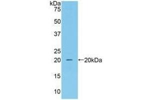 Detection of Recombinant CAT, Mouse using Polyclonal Antibody to Catalase (CAT) (Catalase 抗体  (AA 80-239))
