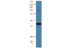 Lane 1:mouse spleen lysate probed with Rabbit Anti-Adenosine deaminase Polyclonal Antibody, Unconjugated  at 1:5000 for 90 min at 37˚C. (ADA 抗体  (AA 65-170))