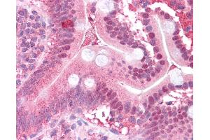 Immunohistochemistry (IHC) image for anti-Mitogen-Activated Protein Kinase Kinase 2 (MAP2K2) (N-Term) antibody (ABIN2783572) (MEK2 抗体  (N-Term))