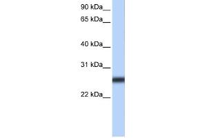 WB Suggested Anti-TMPRSS5 Antibody Titration:  0. (TMPRSS5 抗体  (Middle Region))