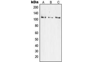 Western blot analysis of JIK expression in HeLa (A), Jurkat (B), HEK293 (C) whole cell lysates. (TAO Kinase 3 抗体  (Center))