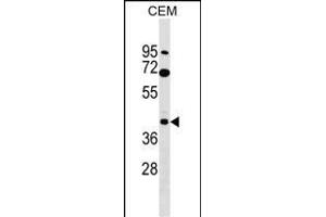 CACNG3 Antibody (N-term) (ABIN1539258 and ABIN2849710) western blot analysis in CEM cell line lysates (35 μg/lane). (CACNG3 抗体  (N-Term))