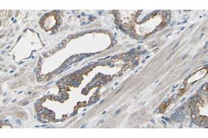 ABIN6277567 at 1/100 staining Human prostate tissue by IHC-P. (EIF4B 抗体  (Internal Region))