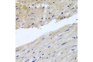 Immunohistochemistry of paraffin-embedded rat heart using RAB24 antibody (ABIN5974578) at dilution of 1/100 (40x lens). (RAB24 抗体)