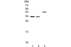 Western blot testing of 1) rat liver, 2) mouse liver and 3) human SMMC-7721 lysate with Regucalcin antibody at 0. (Regucalcin 抗体)