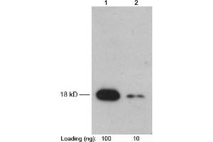 Lane 1-2: Recombinant Trx-tag fusion protein in E. (Trx Tag 抗体)