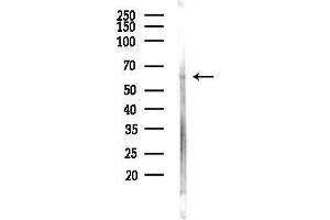 Western blot analysis of lysates from 293 cells(UV,30 min treatment), using STAM1 Antibody at 1/1000 dilution.