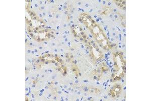 Immunohistochemistry of paraffin-embedded rat kidney using DISC1 antibody. (DISC1 抗体  (AA 1-200))
