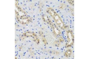 Immunohistochemistry of paraffin-embedded rat kidney using DISC1 antibody. (DISC1 抗体  (AA 1-200))