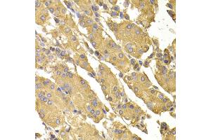 Immunohistochemistry of paraffin-embedded human stomach using PPP2CA antibody. (PPP2CA 抗体)