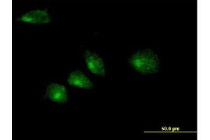Immunofluorescence of purified MaxPab antibody to GOSR2 on HeLa cell. (GOSR2 抗体  (AA 1-213))