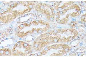 Immunohistochemistry (Paraffin-embedded Sections) (IHC (p)) image for anti-Ribosomal Protein L7 (RPL7) antibody (ABIN7261876)
