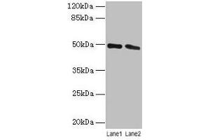 Western blot All lanes: STAMBP antibody at 12 μg/mL Lane 1: Jurkat whole cell lysate Lane 2: Hela whole cell lysate Secondary Goat polyclonal to rabbit IgG at 1/10000 dilution Predicted band size: 49, 40 kDa Observed band size: 49 kDa (STAMBP 抗体  (AA 1-424))
