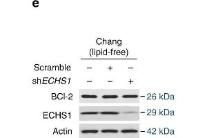 Nutrient induces apoptosis resistance. (Bcl-2 抗体)
