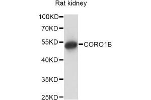 Western blot analysis of extracts of rat kidney, using CORO1B antibody (ABIN6290258) at 1:1000 dilution. (CORO1B 抗体)