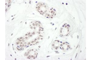 Immunohistochemistry (IHC) image for anti-Forkhead Box C1 (FOXC1) (AA 375-425) antibody (ABIN7453631)