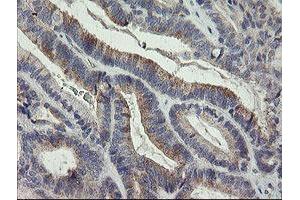 Image no. 1 for anti-Leucine Proline-Enriched Proteoglycan (Leprecan) 1 (LEPRE1) antibody (ABIN1499129) (LEPRE1 抗体)