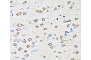 Immunohistochemistry of paraffin-embedded Rat brain using COPB2 Polyclonal Antibody at dilution of 1:100 (40x lens). (COPB2 抗体)