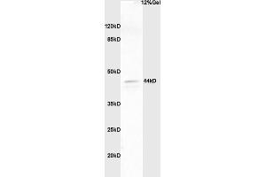 Lane 1: human colon carcinoma lysates probed with Anti phospho-ERK1/2(Thr202 + Tyr204) Polyclonal Antibody, Unconjugated (ABIN682933) at 1:200 in 4 °C.