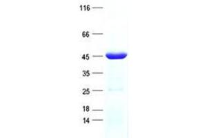 Western Blotting (WB) image for PDZ and LIM Domain 3 (PDLIM3) protein (His tag) (ABIN5505739)