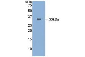 Detection of Recombinant PDXK, Mouse using Polyclonal Antibody to Pyridoxal Kinase (PDXK) (PDXK 抗体  (AA 29-285))